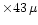 $\times 43\,\mu$